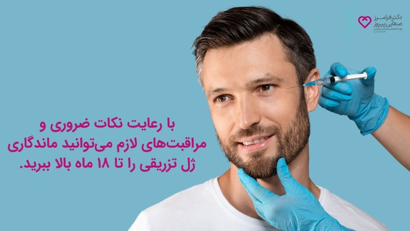 ماندگاری تزریق ژل به زیر چشم